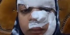 زوج يمزق وجه ويد زوجته بسبب دعوى خلع بالغربية
