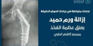 نجاح فريق العظام بمجمع الأقصر الطبى فى استئصال ورم حميد لسيدة فى الثلاثينات