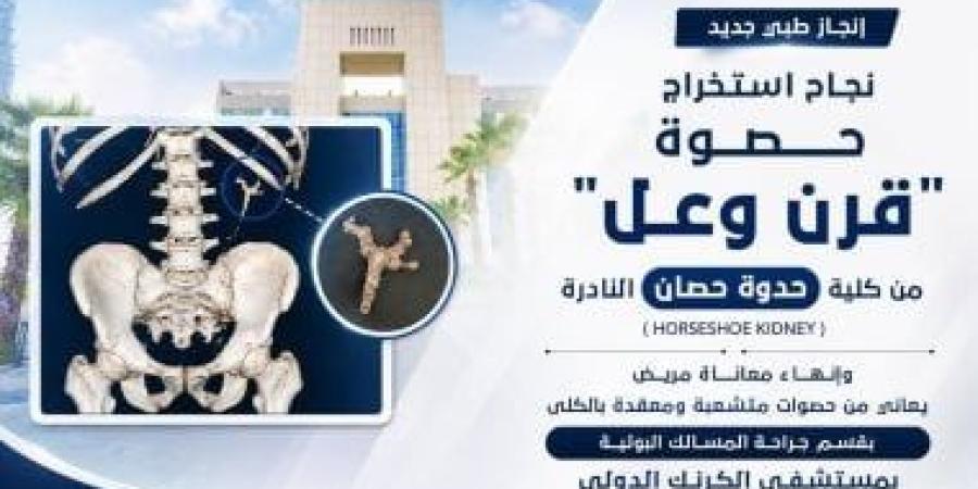 استخراج حصوة فى عملية جراحية نادرة لمواطن أربعيني بمستشفى الكرنك بالأقصر